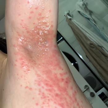 Medicana Sağlık Grubu Yanlış Teşhis, Etkisiz Tedavi ve Empati Eksikliği