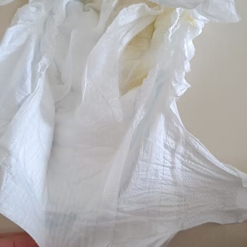 Molfix Junior Bebek Bezlerinde İç Tabaka Kağıt Gibi Kopuyor