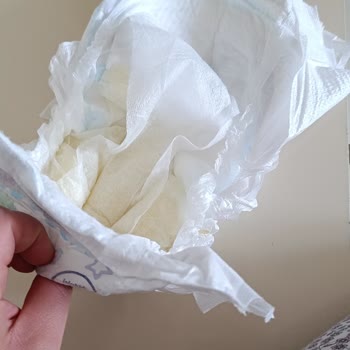 Molfix Junior Bebek Bezlerinde İç Tabaka Kağıt Gibi Kopuyor