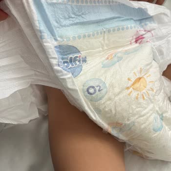 Molfix Bezlerinde Sızdırmazlık Sorunu