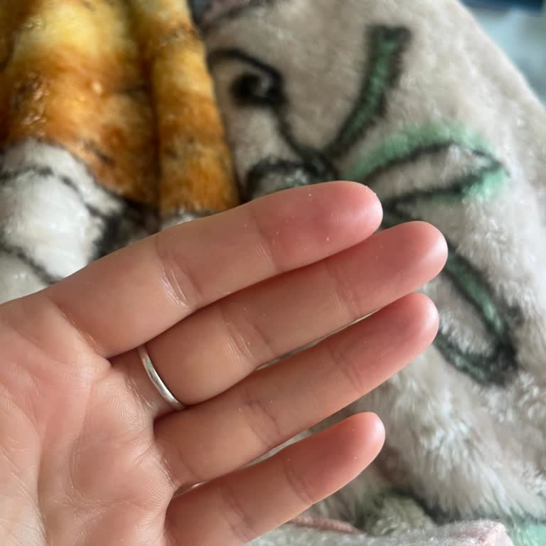 Orijinal Olmadığı Şüpheli Dr. Althea 345 Kremi, Garip Koku Ve Cilt Pul Dökülmesi, İade Talebi