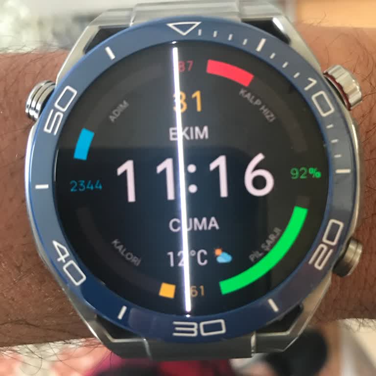 Huawei Akıllı Saat Ekran Arızası İçin Aşırı Ücret Şikayeti