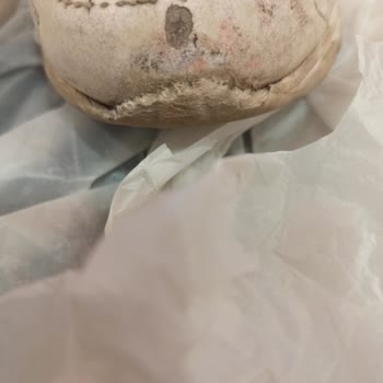 Kısa Sürede Deforme Olan Ayakkabıda Garanti Reddi Ve İade Talebi