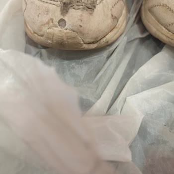 Kısa Sürede Deforme Olan Ayakkabıda Garanti Reddi Ve İade Talebi