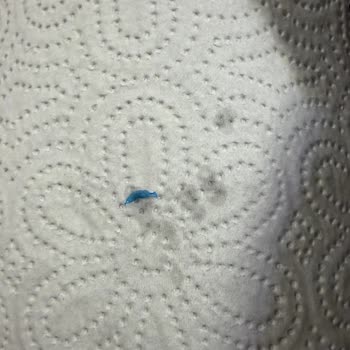 BİM Dönerinde Mavi Plastik Parça Tespit Edildi Gıda Güvenliği Sorunu