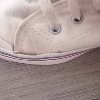 Ayakkabının Kısa Sürede Açılması Ve Müşteri Destek Erişim Sorunu
