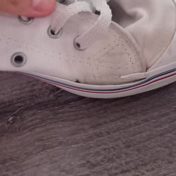 Ayakkabının Kısa Sürede Açılması Ve Müşteri Destek Erişim Sorunu