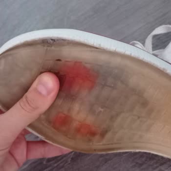 Ayakkabının Kısa Sürede Açılması Ve Müşteri Destek Erişim Sorunu