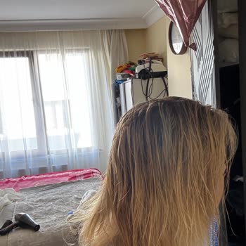 Saçlarım Yanarak Renk Değiştirdi, Kuaför Çözüm Sunmadı