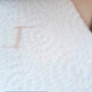 Derya Ton Balığında Kılçık