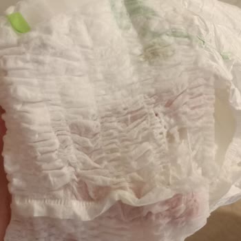 Yırtık Bezler Ve Mağaza Yardım Eksikliği