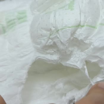 Yırtık Bezler Ve Mağaza Yardım Eksikliği