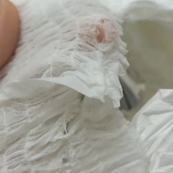 Yırtık Bezler Ve Mağaza Yardım Eksikliği