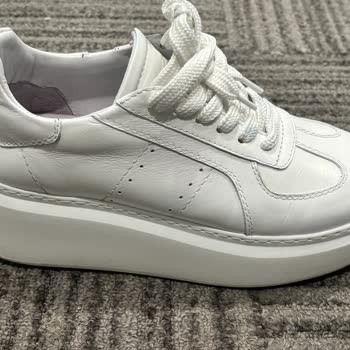 Sert Ve Dar Deri Sneaker Ayak Yaralıyor, Değişim Reddedildi