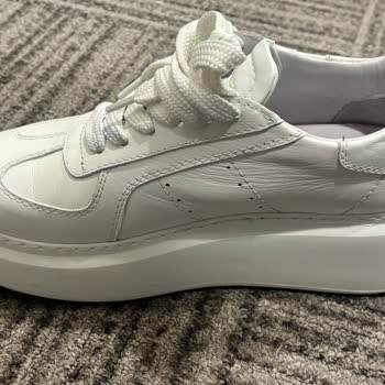 Sert Ve Dar Deri Sneaker Ayak Yaralıyor, Değişim Reddedildi