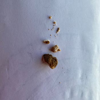 Harras Dondurulmuş Sebzelerinde Sert Taş Gibi Yabancı Madde Bulundu