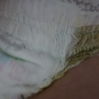 Sleepy Ultra Çocuk Bezinde Yırtık Ve Sızıntı Sorunu