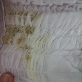 Sleepy Ultra Çocuk Bezinde Yırtık Ve Sızıntı Sorunu