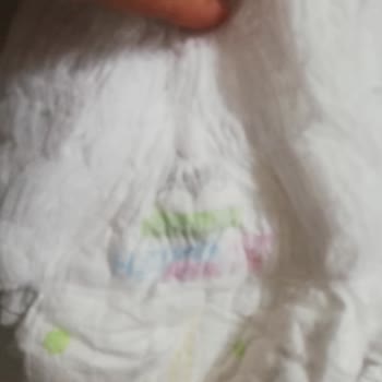 Sleepy Ultra Çocuk Bezinde Yırtık Ve Sızıntı Sorunu