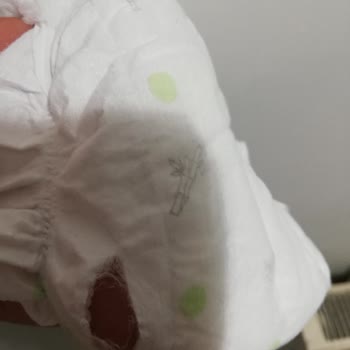 Sleepy Ultra Çocuk Bezinde Yırtık Ve Sızıntı Sorunu