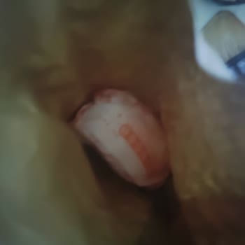 Popeyes Siparişinde Eksik Tavuk Burger İçin İade Talebi