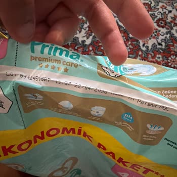 Parfümlü Bebek Bezinde Şiddetli Cilt Yaraları Ve Sürekli Değişim Zorluğu