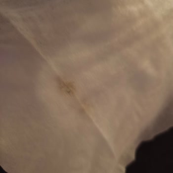 Küflü Bebek Mendili Paketi: Üretim Ve Kontrol Süreçlerine Güven Kırıldı