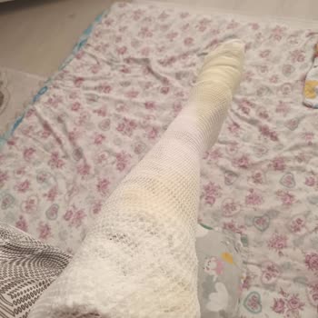 Karaca Home Düdüklü Tencere Patlaması Ve Sorumluluk Reddi