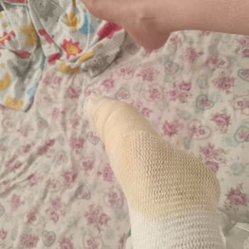 Karaca Home Düdüklü Tencere Patlaması Ve Sorumluluk Reddi
