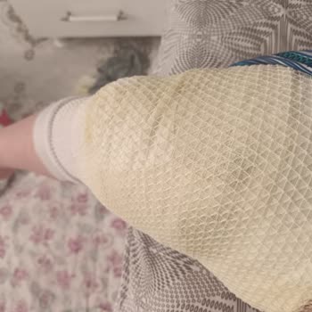 Karaca Home Düdüklü Tencere Patlaması Ve Sorumluluk Reddi