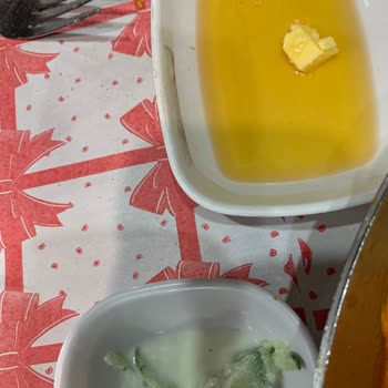 Kelin Yeri'nde Hijyen Sorunu Ve Saygısız Personel
