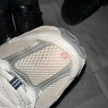 New Balance 530 Ayakkabısında Üretim Hatası Ve Garanti Kapsamındaki Çözüm Eksikliği