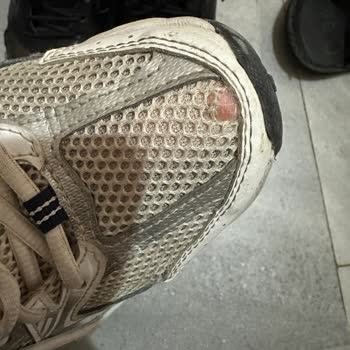 New Balance 530 Ayakkabısında Üretim Hatası Ve Garanti Kapsamındaki Çözüm Eksikliği