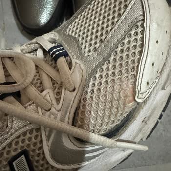 New Balance 530 Ayakkabısında Üretim Hatası Ve Garanti Kapsamındaki Çözüm Eksikliği