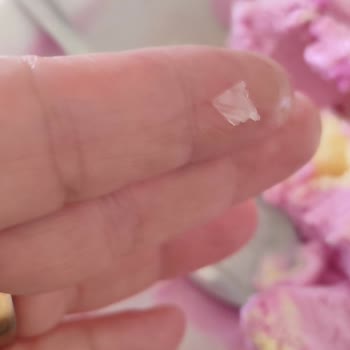 Algida Naturella Dondurmanın İçinde Cam Parçası: Ağzımı Yaktı Ve Güvenim Sarsıldı
