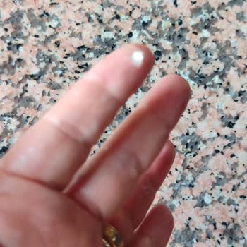 Algida Naturella Dondurmanın İçinde Cam Parçası: Ağzımı Yaktı Ve Güvenim Sarsıldı