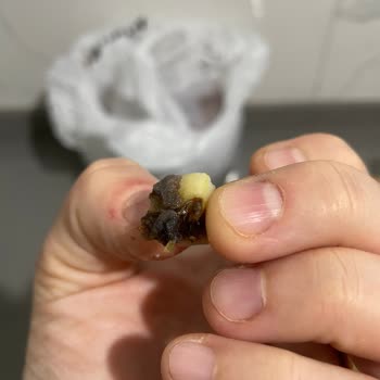 Bozulmuş Konserve Garnitür Üzerinden Sağlık Riski Ve İade Reddi