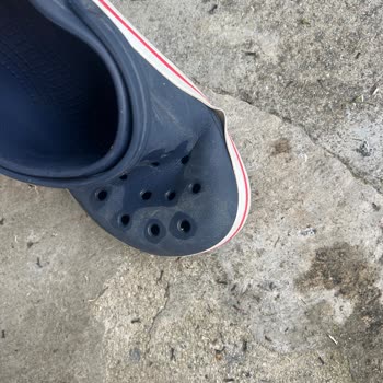 Crocs Terliği Bir Yılda Çatladı, Değişim Talebi