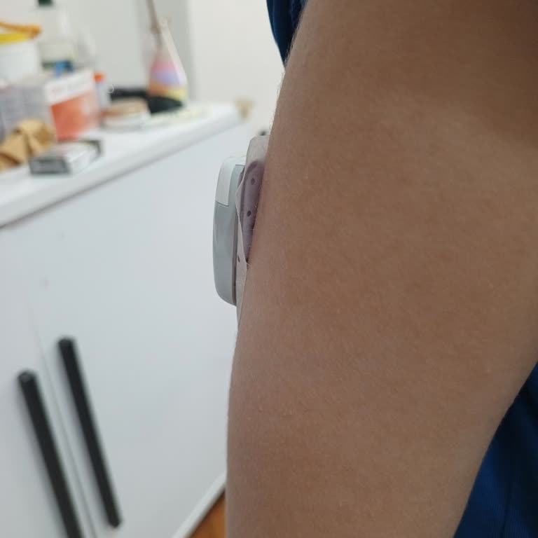 Medtrum Insülin Pompası Bantları Yapışmıyor Ve Çocuk Güvenliğini Tehdit Ediyor