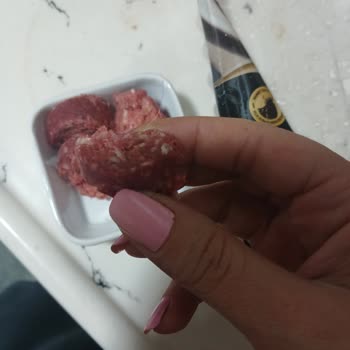 Namet Mangal Sucukta Kıl Görülmesi Güvenimi Sarsan Hijyen Sorunu