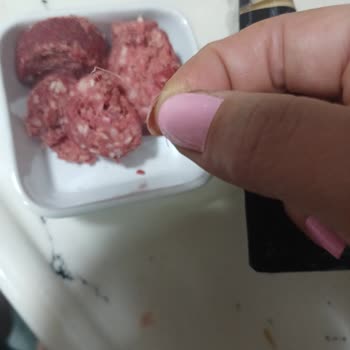 Namet Mangal Sucukta Kıl Görülmesi Güvenimi Sarsan Hijyen Sorunu
