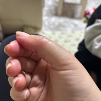 Sour Chery Parfümü Kıyafet Ve Ciltte Pembe Lekeler Bırakıyor