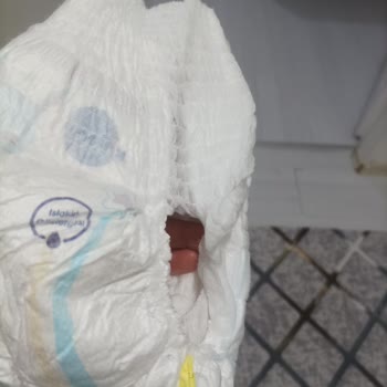 Molfix 5 Numaralı Külot Bezlerinde Sızdırma, Yırtık Ve Yapışkan Sorunları
