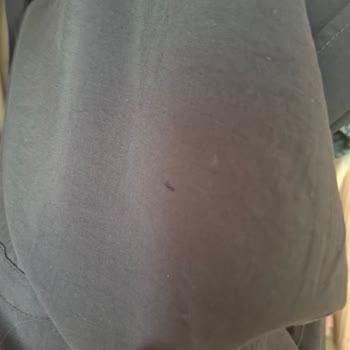 Gömlekte Yırtık Ve Müşteri Hizmetlerine Cevap Yok