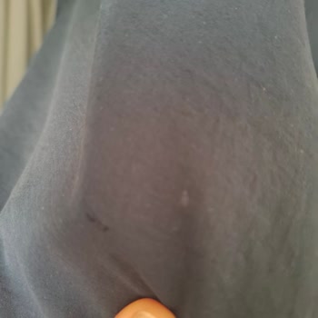 Gömlekte Yırtık Ve Müşteri Hizmetlerine Cevap Yok