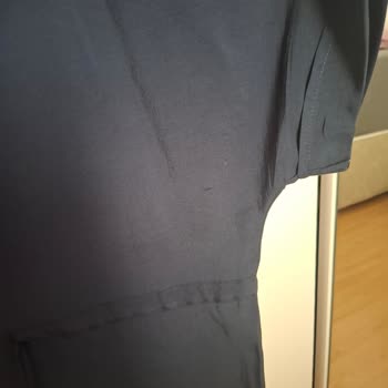 Gömlekte Yırtık Ve Müşteri Hizmetlerine Cevap Yok