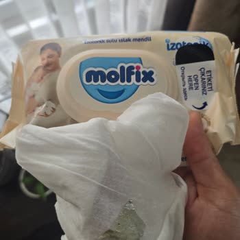 Molfix Islak Mendilinde Yabancı Madde Bulundu, Bebek Güvenliği Tehlikede