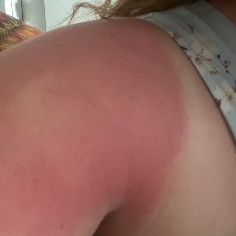 Ozon Güneş Koruma Spreyi +50 Vücudumu Yakıyor