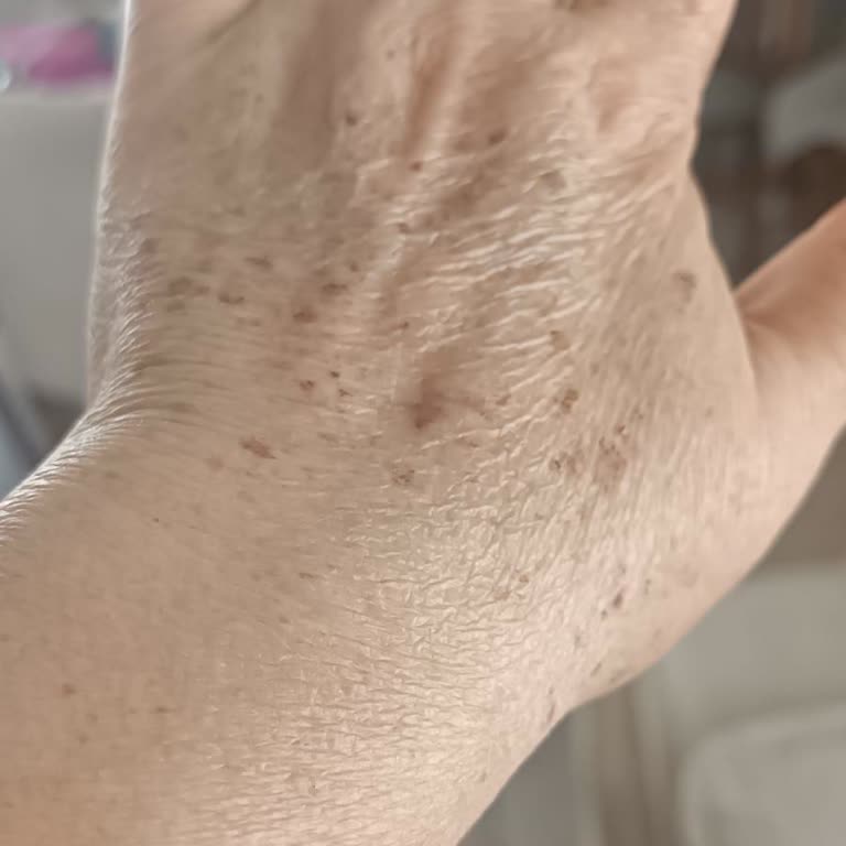 Lazer İşleminde Söz Verilen Sonuç Görülmedi Ve Ücret İadesi Talebi