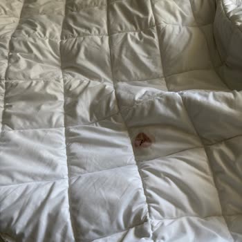 Dora Termal Otel’de Hijyen, Güvenlik Ve Konfor Eksikliği